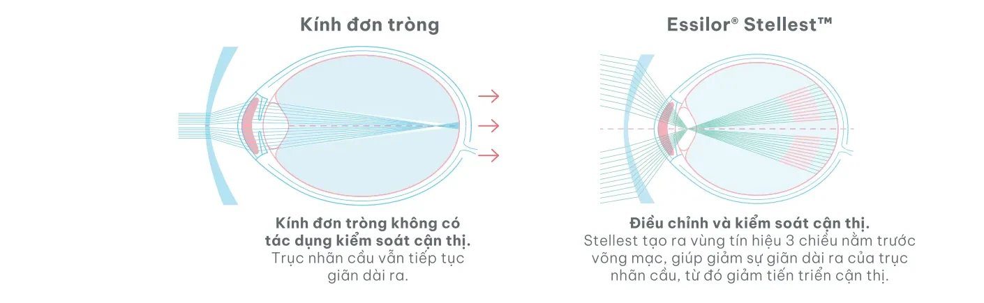 So sánh đường đi của ánh sáng qua kính đơn tròng và qua tròng Essilor Stellest